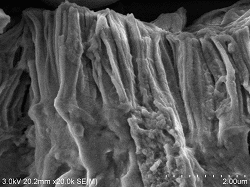 Proximal-tubule-conductive-staining3